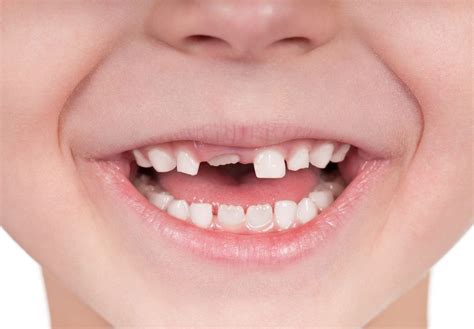 Dental Health And Kids A Guide For Every Age Live Science