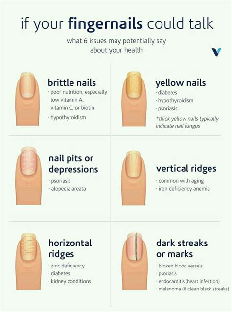 Pin By Michelle A On Capricorn Sayings Fingernail Health Nail