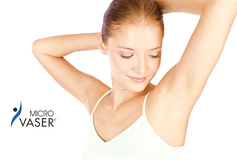 Excessive Sweating Treatment Vaser Treatment For Axillary Hyperhidrosis