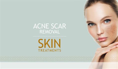 Acne Scar Removal Treat Acne And Pimple Scars Scinn