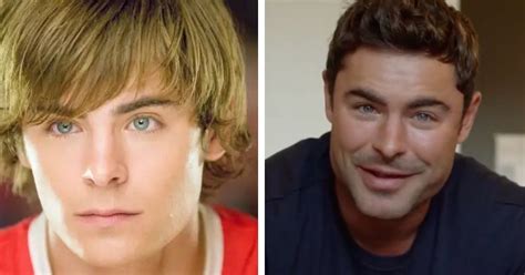 Zac Efron Reveals The Painful Reason Behind His Changed Jawline