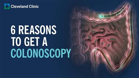 6 Reasons To Get A Colonoscopy Youtube