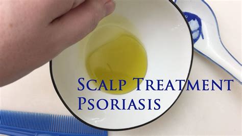 Scalp Treatment For Psoriasis Youtube