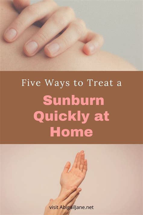 Five Ways To Treat A Sunburn Quickly At Home How To Treat Sunburn