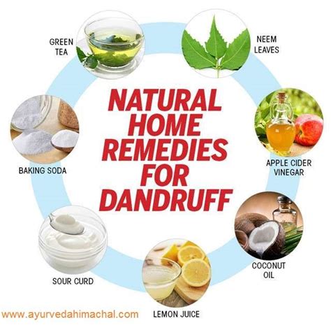 Natural Home Remedies For Dandruff In 2020 Home Remedies For Dandruff