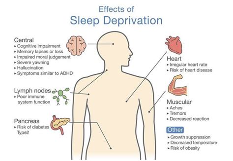 ohc truths 01 why is sleep so important orchard health clinic osteopathy physiotherapy