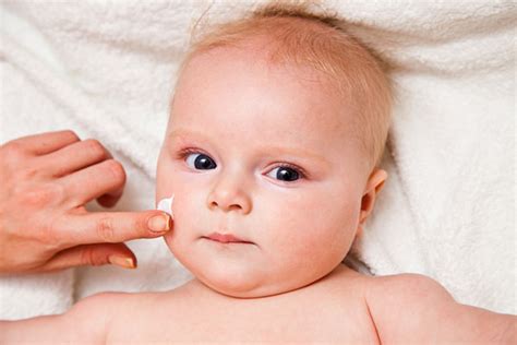What Causes Baby Acne Know The Causes And Treatment