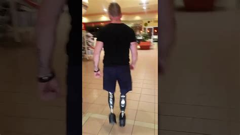 Bilateral Above Knee Amputee Walking With Osseointegration Youtube
