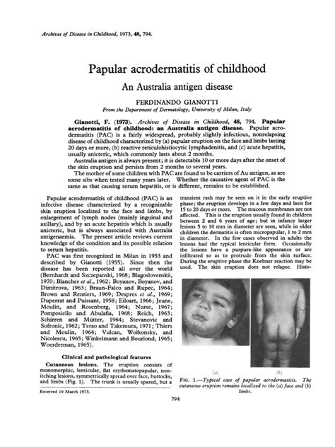 Papular Acrodermatitis Of Childhood An Australia Antigen Pdf