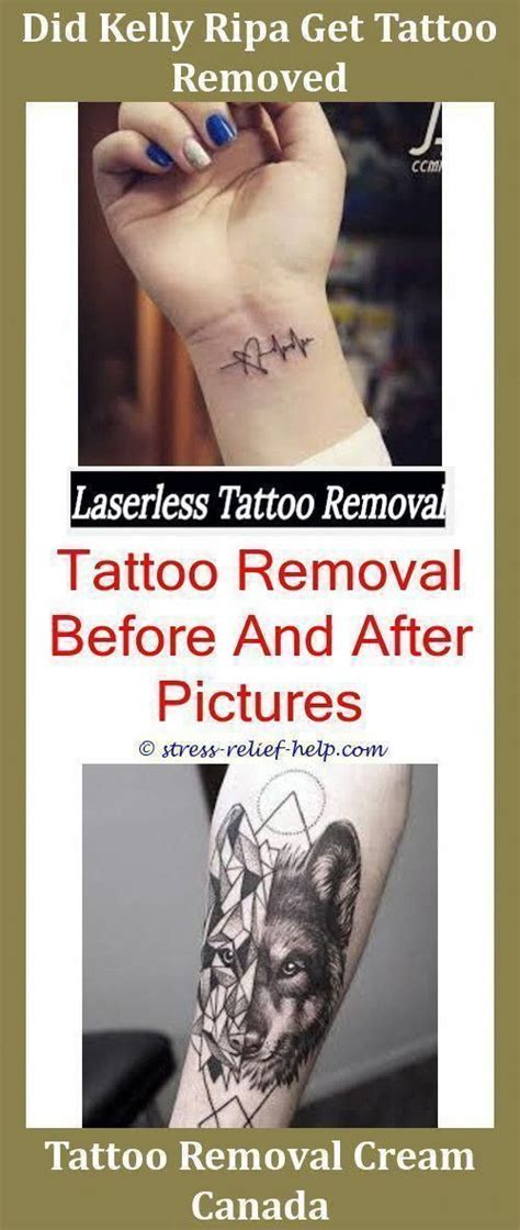 After i found the answer, i decided to slap my research into this article so you can make an educated decision about what may or may not be the best diy tattoo removal laser pen option: Permanent Tattoo Removal Cost How To Remove A Tattoo Yourself At Home,how much is it to remove ...