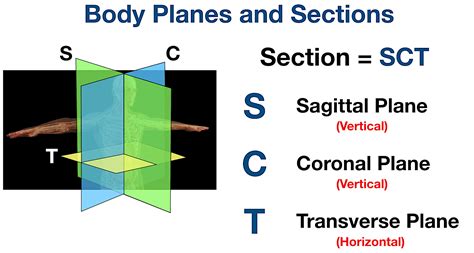 body planes and sections anatomical position directional term definitions example diagram — ezmed