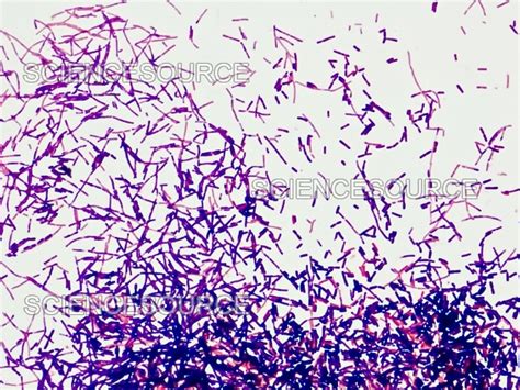 Photograph Gram Positive Bacteria Bacilli Science Source Images