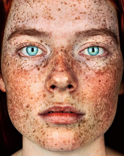 Lond Based Photographer Captures Gorgeous Photos Of Freckled People To