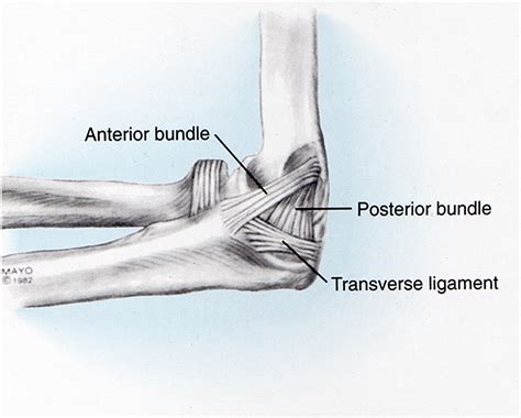 Acute Elbow Dislocations In Athletes Clinics In Sports Medicine