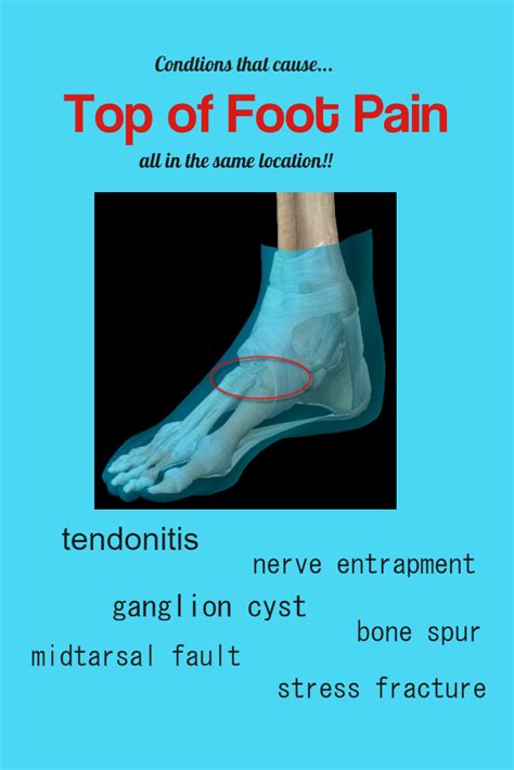This is a long bone that connects the little toe to the middle of the foot. TOP OF FOOT PAIN- Causes, Diagnosis, Treatment, Prevention