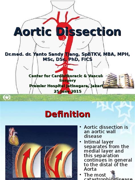 Aortic Dissection Rs Premierppt Medical Specialties Clinical Medicine