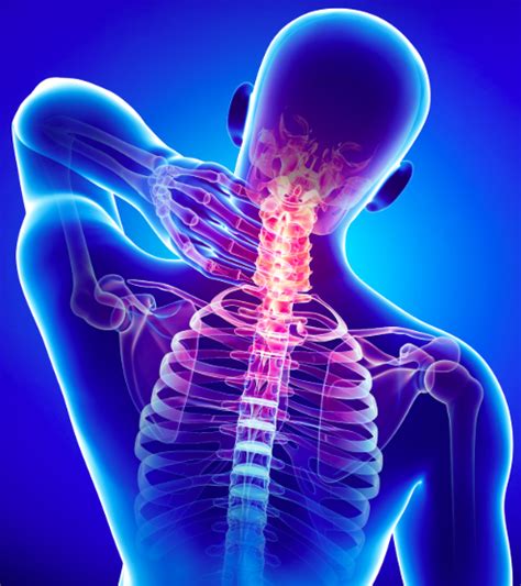 Neck Pain And The Deep Neck Flexors — Dynamic Physio Therapy Naples