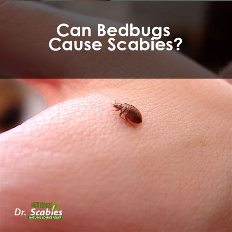 Scabies A Skin Condition Caused By Itch Mites FutonAdvisors