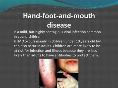 Hand Foot Mouth Oral Lesions