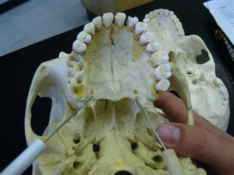 Boned Human Skull Palatine Foramina Of Palatine Bone