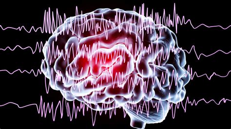 Epilepsie Ursachen Symptome Behandlung Erste Hilfe Docfinder