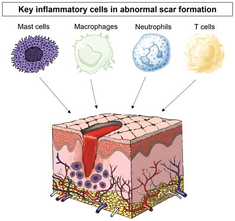 Frontiers Controlling Inflammation Pre Emptively Or At The Time Of