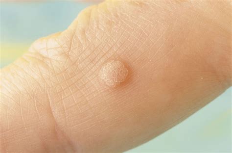 Skin Conditions Symptoms Treatments Diagnosis