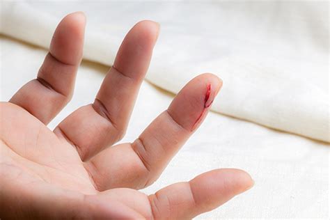 4 Common Fingertip Injuries Athletico