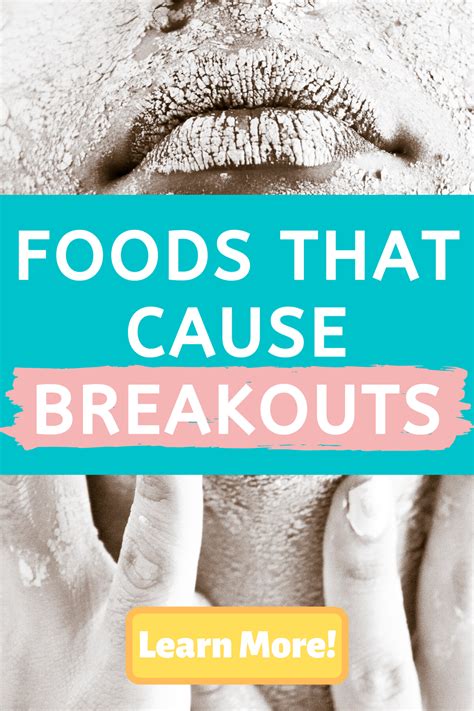 Foods That Cause Breakouts Skin Care Acne Bad Acne Acne