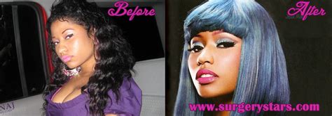nicki minaj plastic surgery before and after nicki minaj photos my xxx hot girl