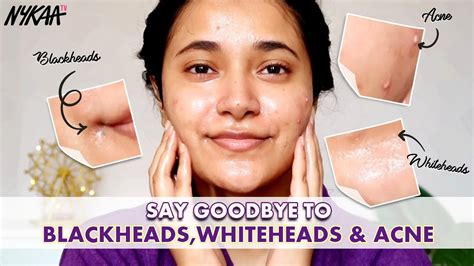 how to remove clogged pores at home get rid of blackheads whiteheads and acne nykaa youtube