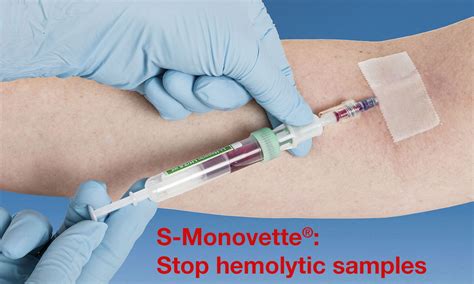 Blood Collection And Sampling System S Monovette Test Kits My XXX Hot