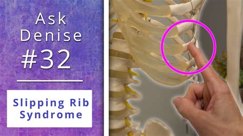 Slipping Rib Syndrome For Yoga Teachers Askdenise 32 Youtube