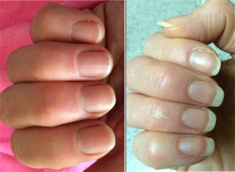 Encourages healthy hair, skin and nails. Want Healthy Nails Fast?