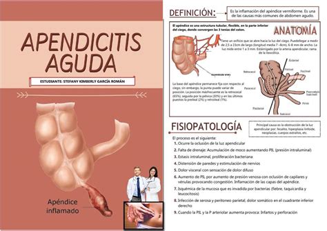 Resumen Apendicitis Aguda Medicina Humana Apendicitis Udocz The Best The Best Porn Website