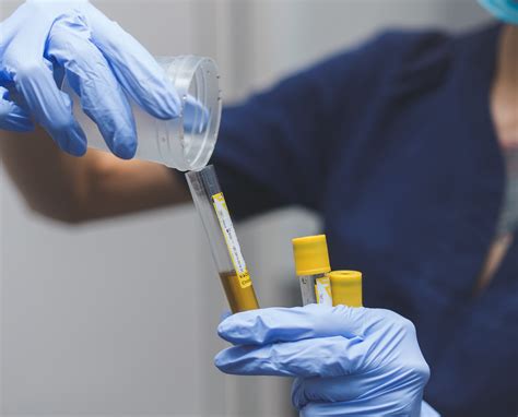 How To Avoid a "Negative Dilute" On Your Drug Test - Fleet Drug Testing