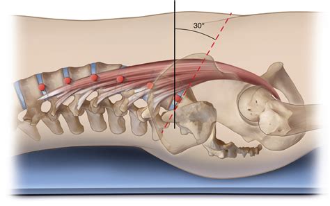 Psoas Major Function Spinal Joint Actions Sagittal Plane