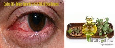 They are not only trendy but beneficial as well. 10 Home Remedies For Dry Eyes- Best Eye Care Tips!