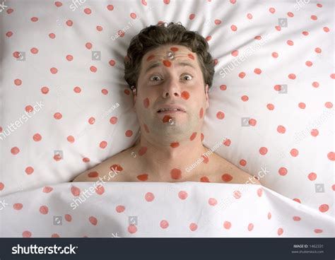 Man Red Spots On Face Body Stock Photo 1462331 Shutterstock
