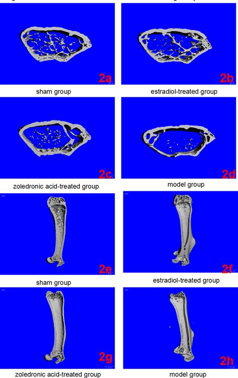 Micro Ct Of Left Femurs In The Four Groups 2a 2d Three Dimensional