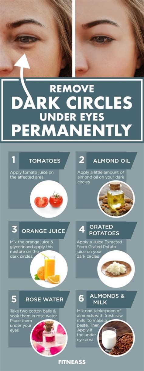 How To Remove Dark Circles Under Eyes Permanently Fitneass Remove Dark Circles Dark Circles