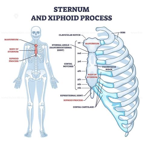 Xiphoid Process Sternum Lump Pain Treatment
