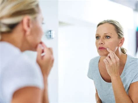 What Causes Dry Itchy Swollen Lips Infoupdate Org