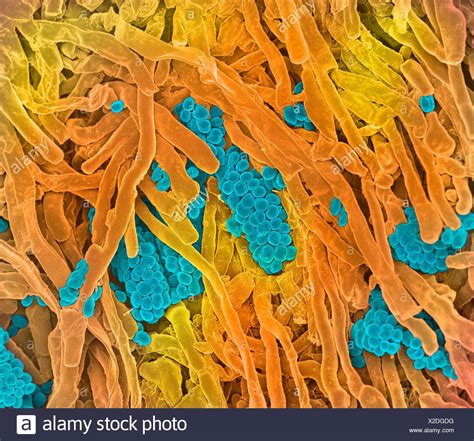 Streptomyces High Resolution Stock Photography And Images Alamy