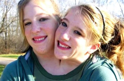 one life for two what the most famous siamese twins brittany and abigail look like now