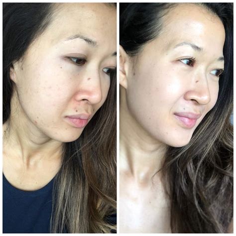 Before shopping at underneath skin care, it's necessary to spend one or two minutes on getting more familiar with this underneath skin care page at hotdeals.com. How ZO Skin Health Changed My Skin in 28 Days - A ...