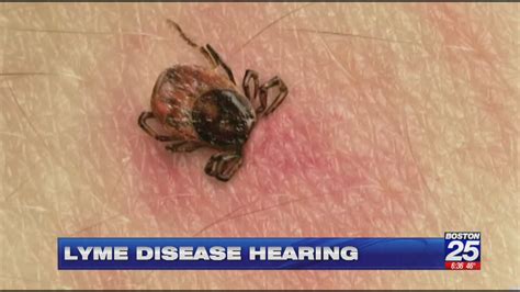 antibody shows promise in fight against lyme disease