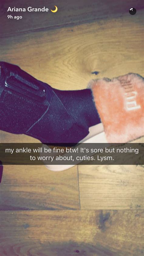 Ariana Grande Snapchats Her Ankle In A Cast Teen Vogue