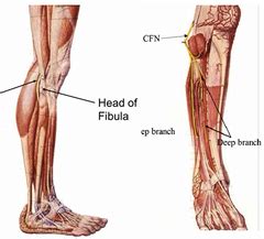 It occurs when the point of the elbow and the muscular structure do not develop normally, and is most commonly seen in large. MSKWk2 Tuesday Flashcards | Quizlet