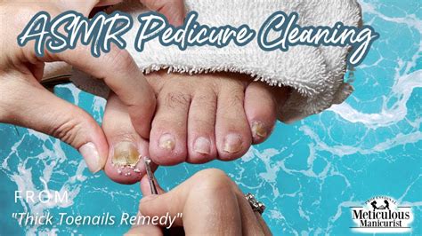 👣asmr Pedicure Cleaning💆‍♀️thick Toenails Remedy👣 Youtube